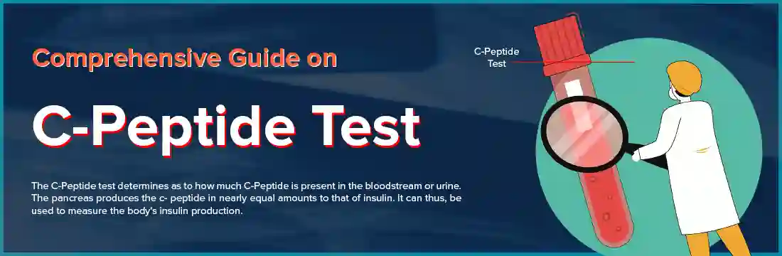 Comprehensive Guide on C-Peptide Test